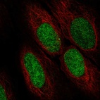 Anti-ASF1A Antibody