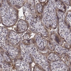 Immunohistochemical staining of human placenta shows moderate cytoplasmic positivity in trophoblastic cells.