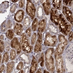 Immunohistochemical staining of human kidney shows strong cytoplasmic positivity in cells in tubules.