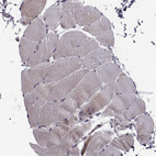 Immunohistochemical staining of human skeletal muscle shows no positivity in myocytes as expected.