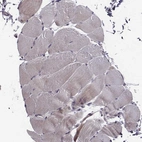 Immunohistochemical staining of human skeletal muscle shows no positivity in myocytes as expected.