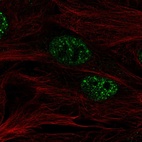 Immunofluorescent staining of human cell line BJ shows localization to nuclear speckles.