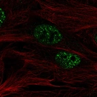 Immunofluorescent staining of human cell line BJ shows localization to nuclear speckles.