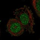 Immunofluorescent staining of human cell line SiHa shows localization to nucleoplasm & nuclear bodies.