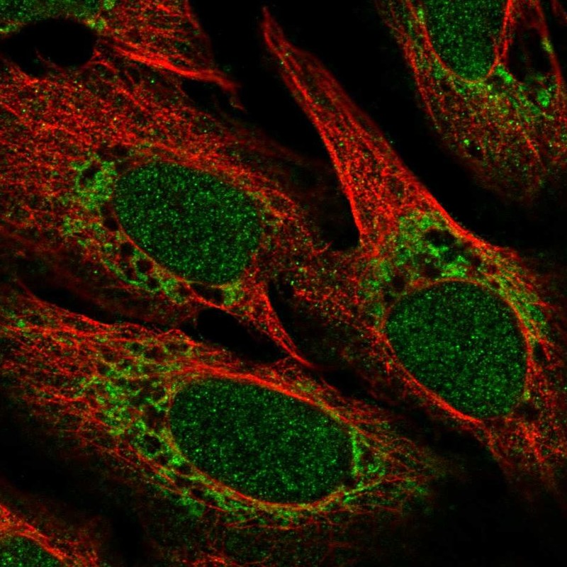 Anti-POLD4 Antibody