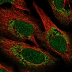 Anti-POLD4 Antibody