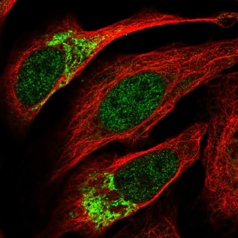 Anti-ZNF398 Antibody