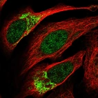 Anti-ZNF398 Antibody