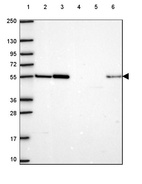 Anti-HS3ST3A1 Antibody