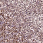 Anti-ZNF616 Antibody