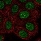 Anti-RARA Antibody