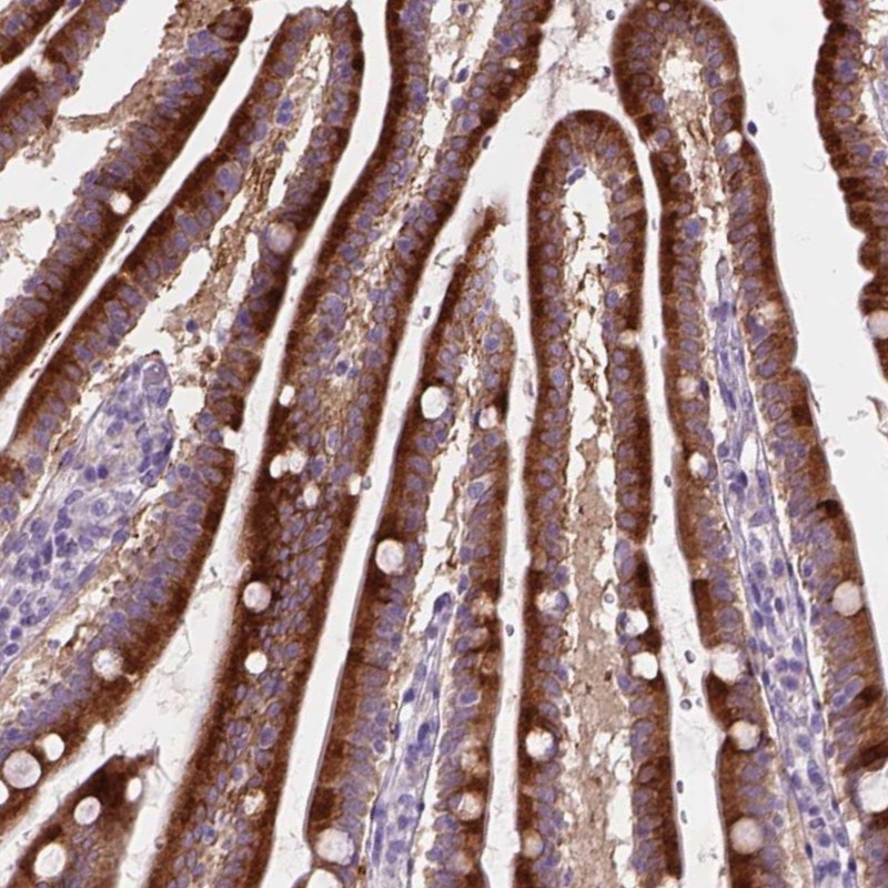 Anti-NOXO1 Antibody