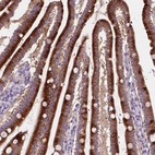 Anti-NOXO1 Antibody