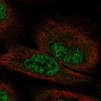 Anti-FGF12 Antibody