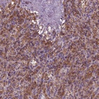 Anti-CYTH4 Antibody