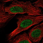Anti-RXRB Antibody