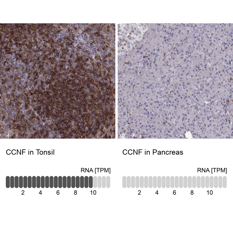 Anti-CCNF Antibody