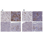 Immunohistochemical staining of human liver, lymph node, pancreas and skin using Anti-CCNF antibody HPA071600 (A) shows similar protein distribution across tissues to independent antibody HPA070495 (B).