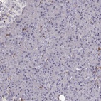 Immunohistochemical staining of human pancreas shows low expression as expected.