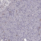 Immunohistochemical staining of human pancreas shows low expression as expected.