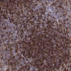 Immunohistochemical staining of human tonsil shows high expression.