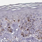 Immunohistochemical staining of human skin using Anti-CCNF antibody HPA071600.