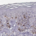 Immunohistochemical staining of human skin using Anti-CCNF antibody HPA071600.