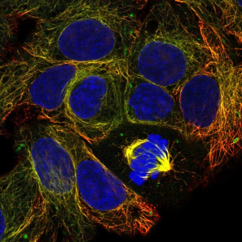 Anti-CFAP99 Antibody