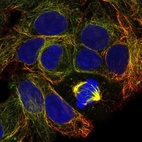 Anti-CFAP99 Antibody