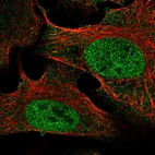 Anti-SETDB2 Antibody