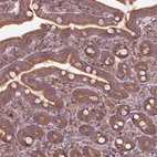 Anti-SLC25A5 Antibody