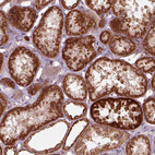 Immunohistochemical staining of human kidney shows strong granular cytoplasmic positivity in cells in tubules.