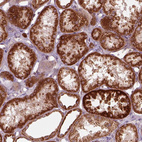 Anti-SLC25A5 Antibody