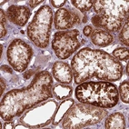 Immunohistochemical staining of human kidney shows strong granular cytoplasmic positivity in cells in tubules.