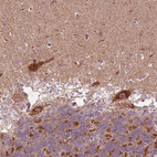 Immunohistochemical staining of human cerebellum shows strong granular cytoplasmic positivity in Purkinje cells and cells in granular layer.