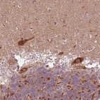Immunohistochemical staining of human cerebellum shows strong granular cytoplasmic positivity in Purkinje cells and cells in granular layer.