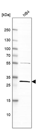 Western blot analysis in human cell line NB4.