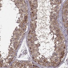 Anti-URI1 Antibody