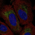 Anti-TMEM185A Antibody