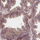 Immunohistochemical staining of human prostate shows weak to moderate membranous positivity in glandular cells.