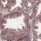 Immunohistochemical staining of human prostate shows weak to moderate membranous positivity in glandular cells.