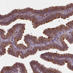 Immunohistochemical staining of human Fallopian tube shows strong positivity in cilia in glandular cells.