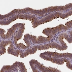 Immunohistochemical staining of human Fallopian tube shows strong positivity in cilia in glandular cells.