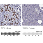 Anti-TRPS1 Antibody