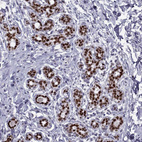 Anti-TRPS1 Antibody