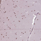 Immunohistochemical staining of human Cerebellum shows strong nuclear positivity in cells in molecular layer.