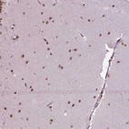 Immunohistochemical staining of human Cerebellum shows strong nuclear positivity in cells in molecular layer.