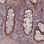 Immunohistochemical staining of human rectum shows moderate to strong cytoplasmic and membranous positivity in glandular cells.