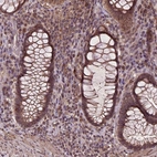 Immunohistochemical staining of human rectum shows moderate to strong cytoplasmic and membranous positivity in glandular cells.