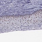 Immunohistochemical staining of human cervix, uterine shows strong nuclear positivity in squamous epithelial cells.